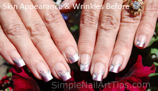 Before using Pure™ Cuticle and Nail Oil - skin appearance