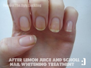 www.NailCareHQ.com Yellow nails before using lemon juice to remove stains 