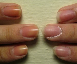Yellow Nails Using Whitening toothpaste
