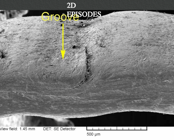Ridges in Nails - Microscopic photo