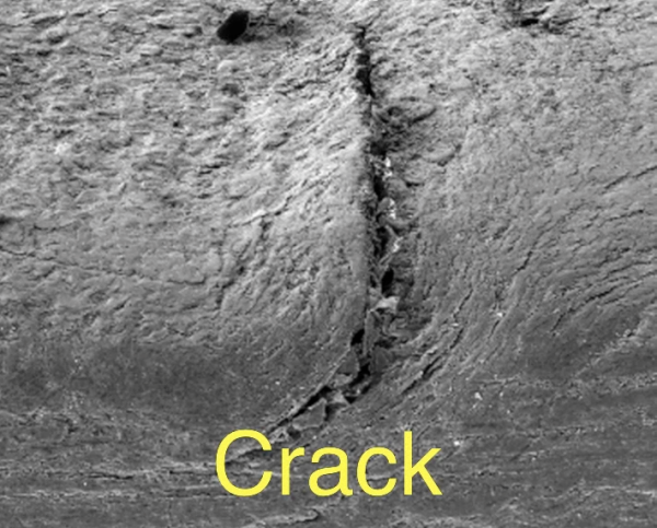 www.NailCareHQ.com Ridges in Nails - Microscopic photo
