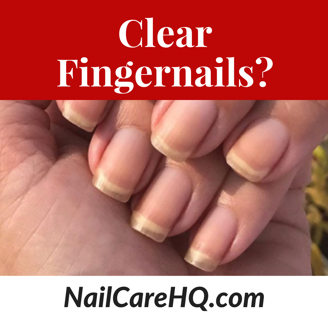 Clear Fingernails?
