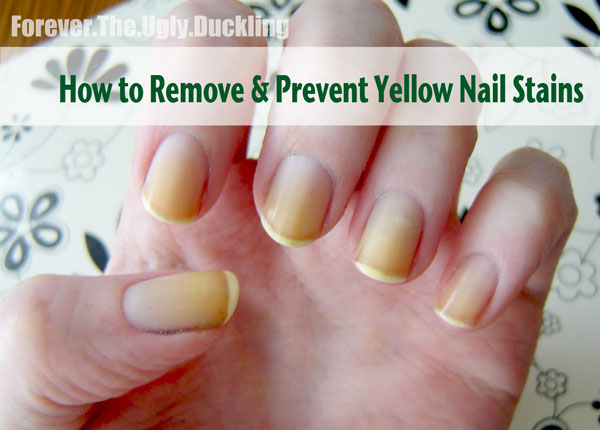 Yellow Nails – Is There a Basecoat that Prevents Staining? | Nail Care HQ