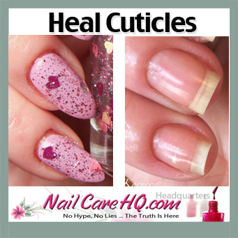 CUTICLE HEALTH – Pure Nail Oil™ Challenger Kimber's Results | Nail Care HQ