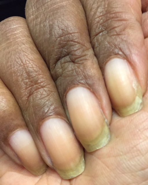 ASK ANA: Peel Off Base Coat – Is It Damaging? | Nail Care HQ