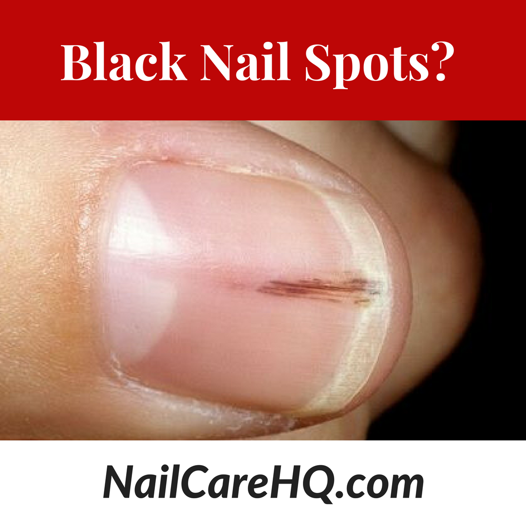 On dot small toenail black Black Lines