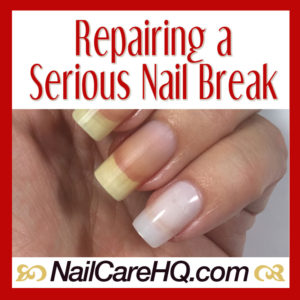 Broken Nail Repair – What To Do When It's Bad | Nail Care HQ