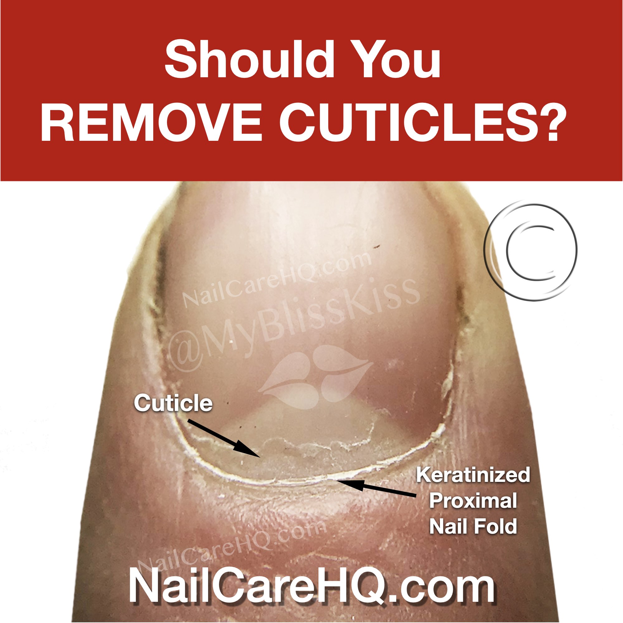 Should You Remove Cuticles? | Nail Care HQ