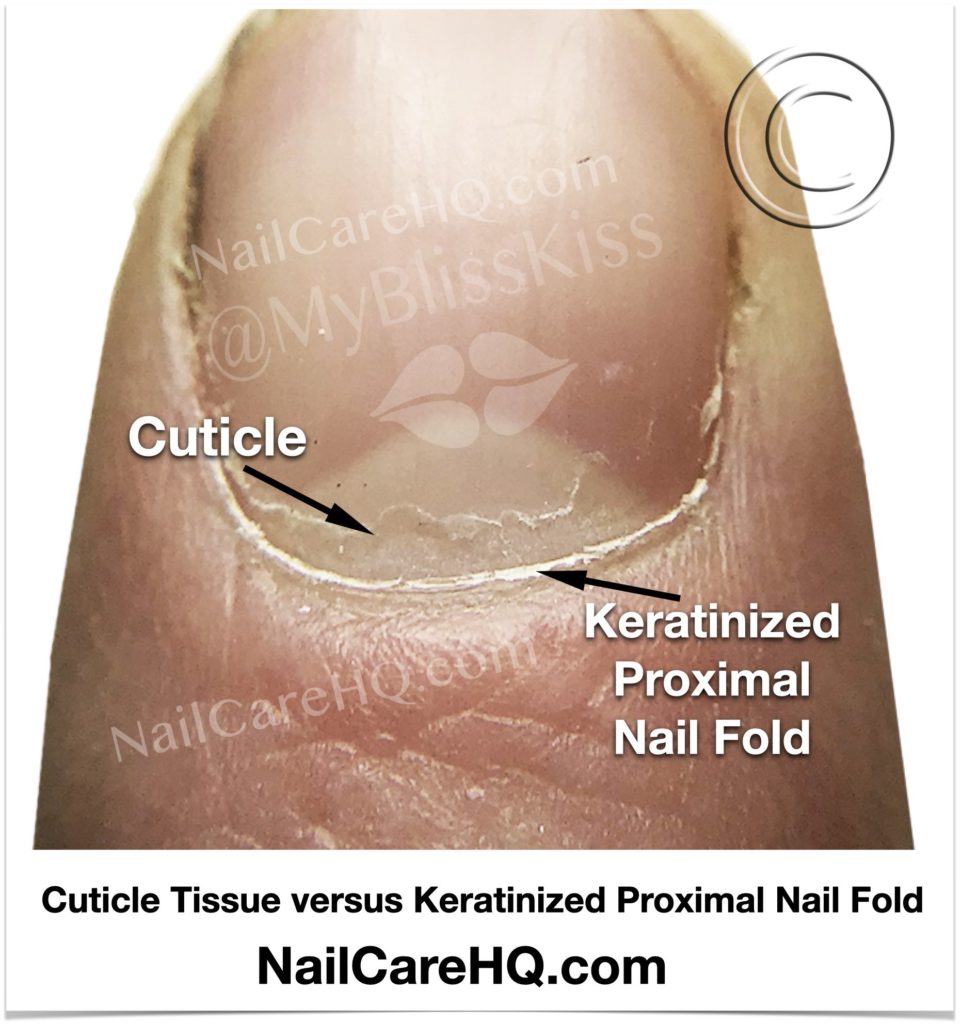 Should You Remove Cuticles? | Nail Care HQ