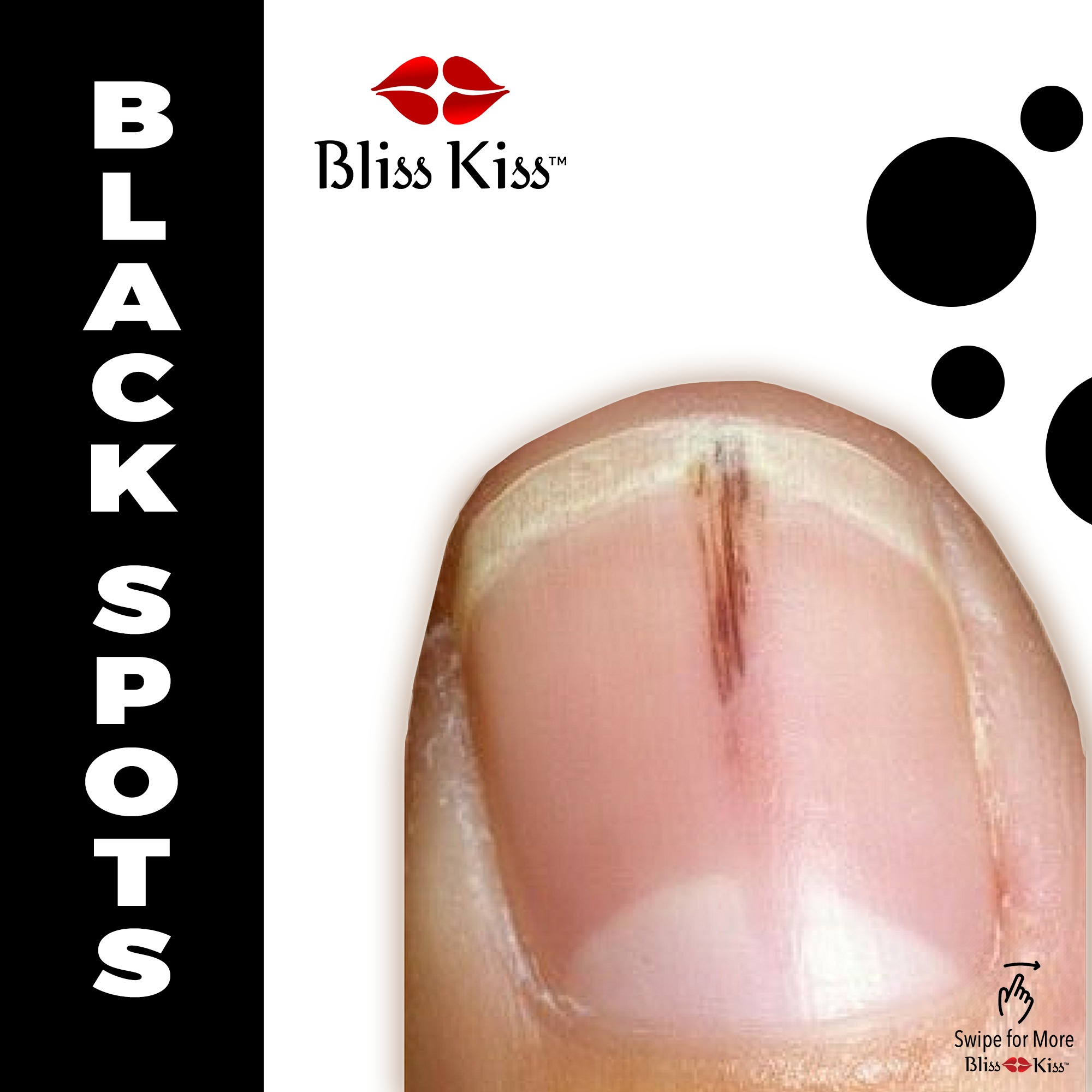 ASK ANA – Black Spots In Nails | Nail Care HQ